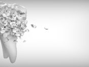 Broken tooth